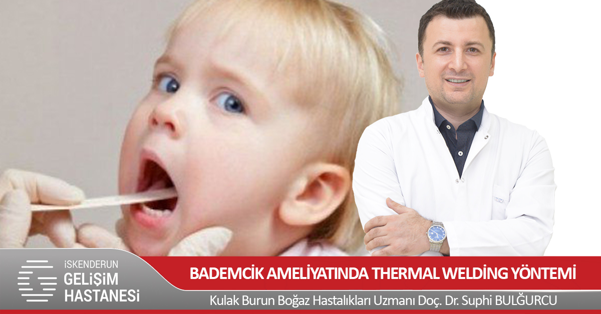 BADEMCİK AMELİYATINDA THERMAL WELDİNG YÖNTEMİ