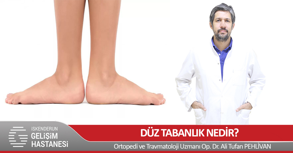 DÜZ TABANLIK NEDİR?
