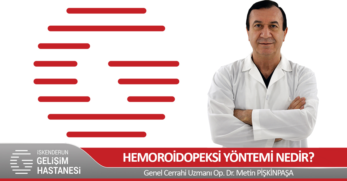 HEMOROİDOPEKSİ YÖNTEMİ NEDİR?