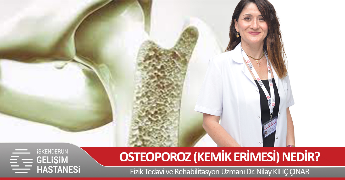 OSTEOPOROZ (KEMİK ERİMESİ) NEDİR?