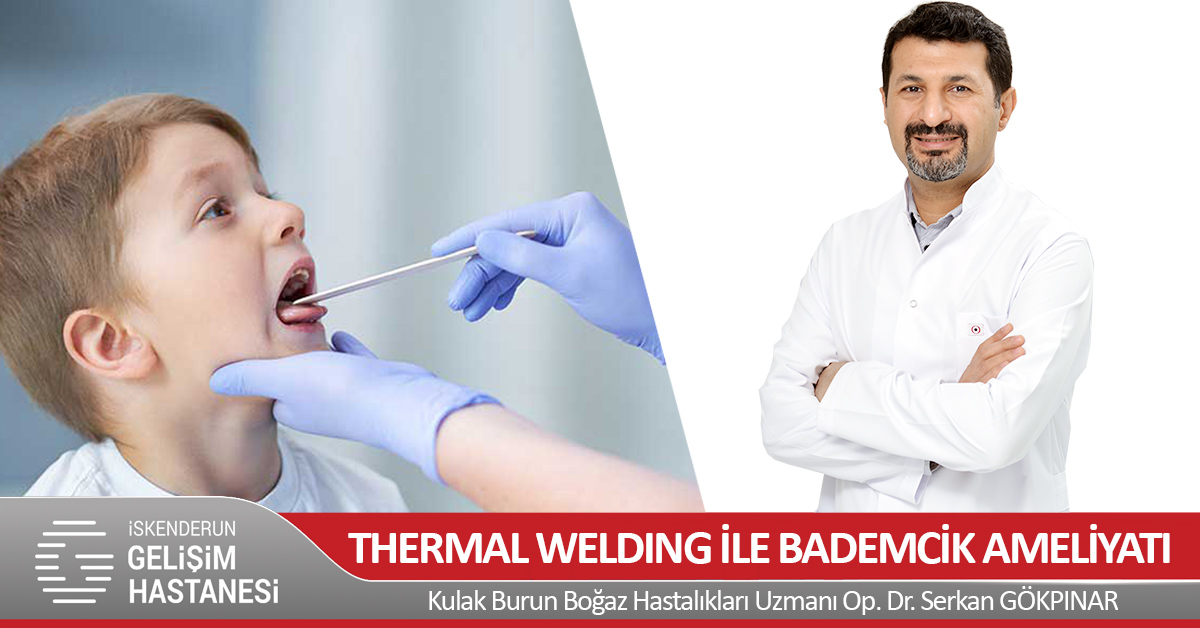 THERMAL WELDING İLE BADEMCİK AMELİYATI